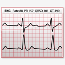 EKG