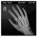 X,Ray,Hand